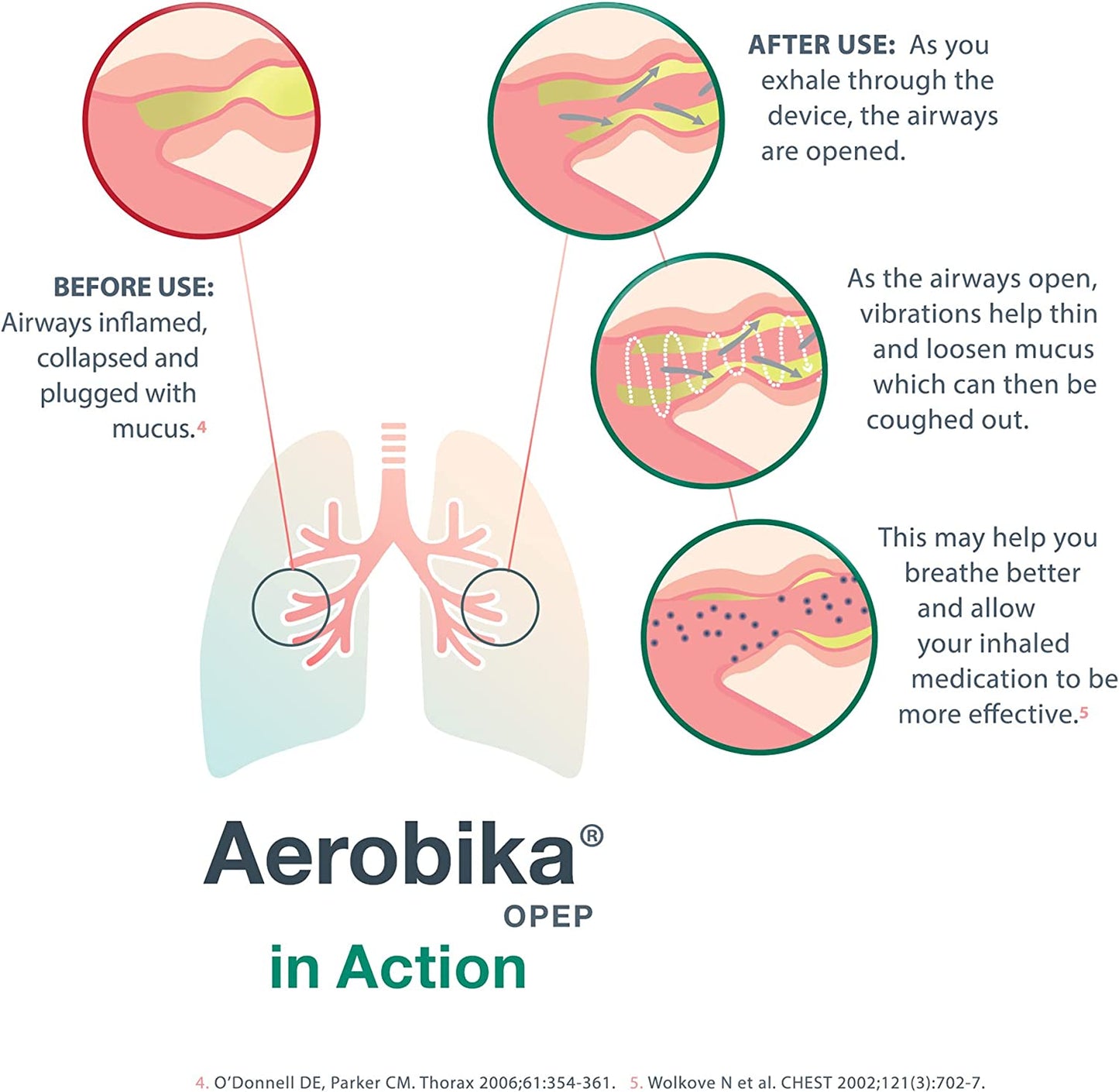 AEROBIKA* OPEP Device | SuppliSave